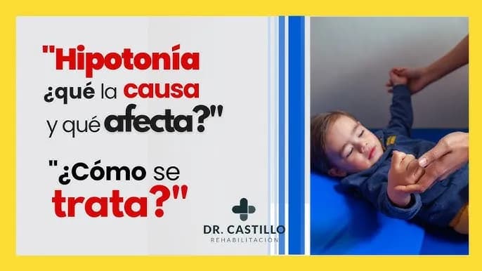 Entendiendo la hipotonía muscular: causas, síntomas y tratamientos esenciales