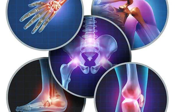 Por qué me duele los músculos: causas, síntomas y soluciones efectivas